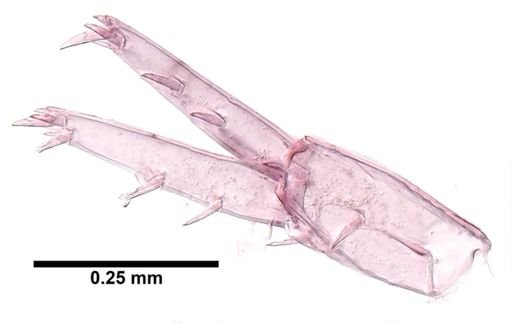 Hyalella cf. azteca