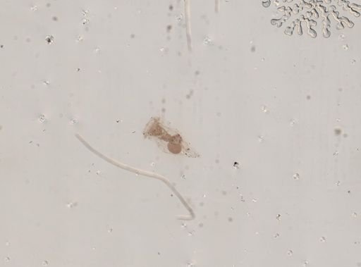 Epiphanes senta