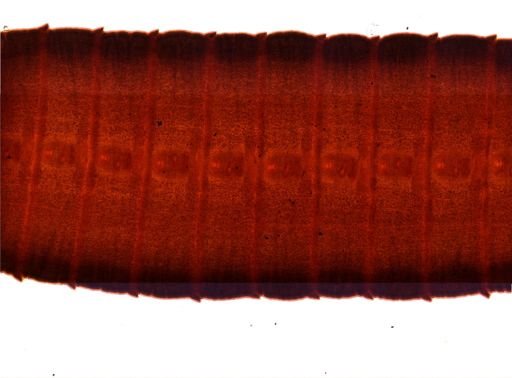 Diphyllobothrium erinacei
