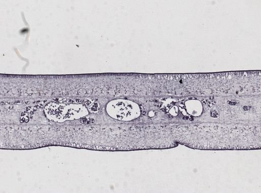 Taenia saginata
