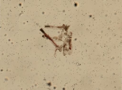 Amathia gracilis
