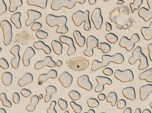 Fasciola hepatica