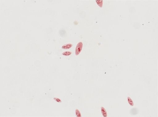 Paramecium calkinsi
