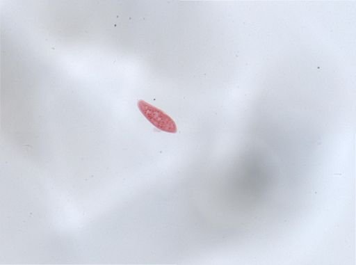 Paramecium aurelia