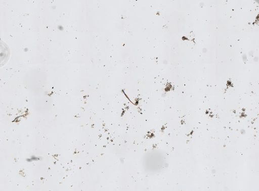 Epitomapta roseola