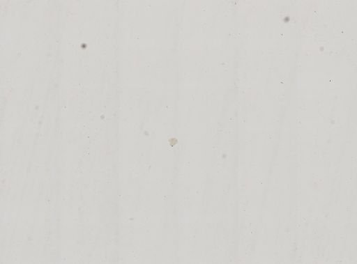 Paramecium polycaryum