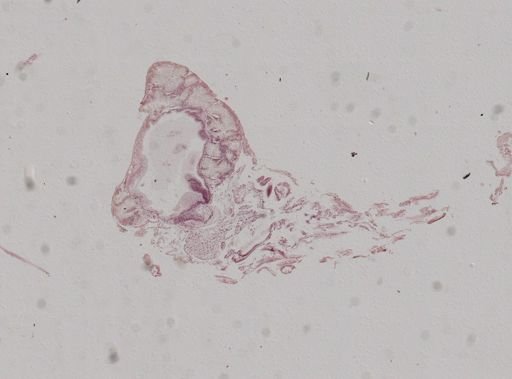 Crepidula plana
