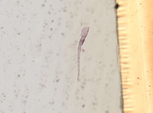 Hyalella cf. azteca