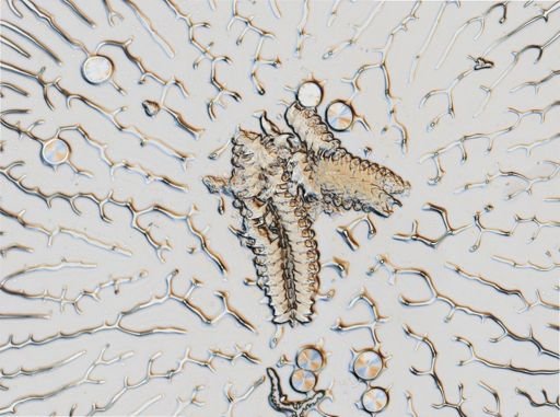 Onchidoris muricata