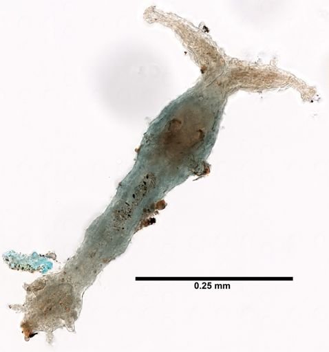 Histriobdella homari