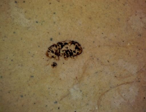 undet. Coleoptera