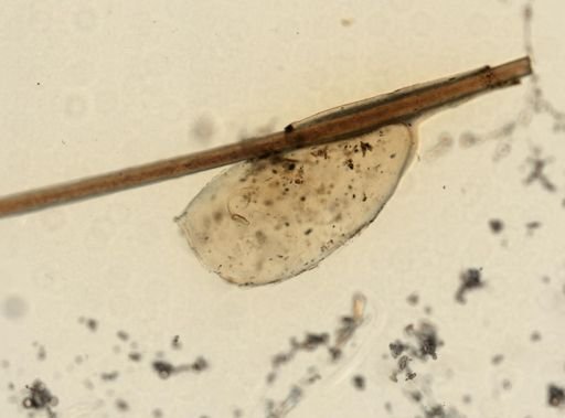 Pediculus humanus