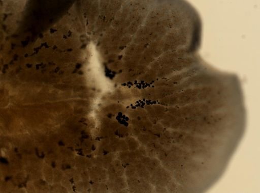 Pleioplana atomata