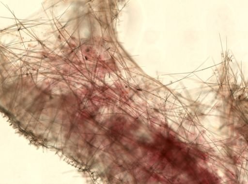 Sympagella nux
