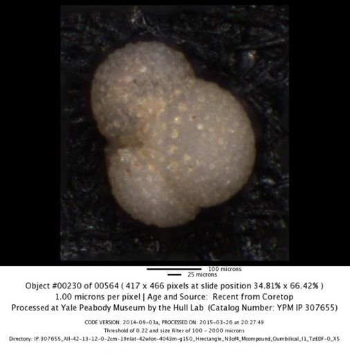 Globigerinoides sacculifer