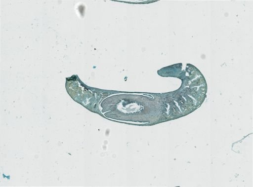 Foviella