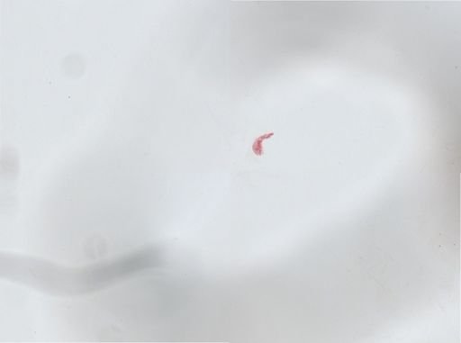 Paramecium
