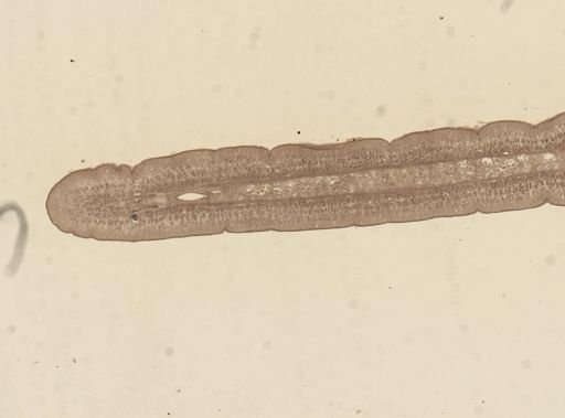 Taenia taeniaeformis