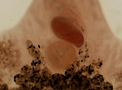 Fasciola hepatica