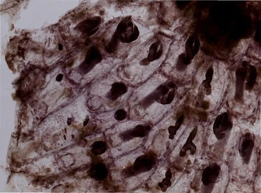 Bryozoa