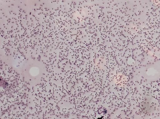 Trypanosoma?