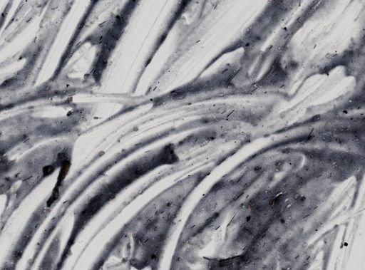 Entamoeba histolytica