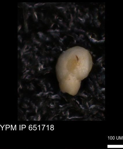 undet. Foraminiferida