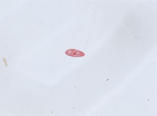Paramecium aurelia