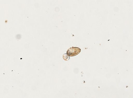 Fasciolopsis buski