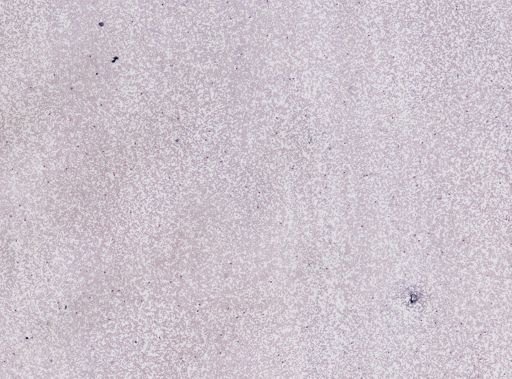 Plasmodium vivax