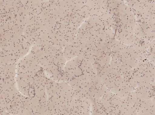 Wuchereria bancrofti