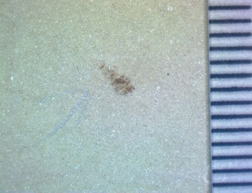 undet. Hexapoda