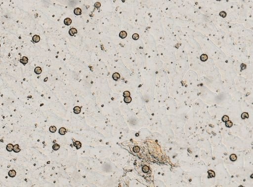 Taenia solium