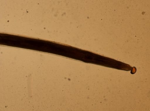 Enterobius vermicularis