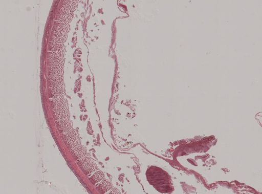 Amynthas heterochaetus