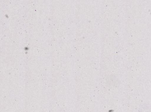 Trypanosoma brucei