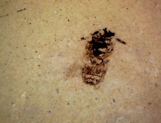 undet. Pterygota