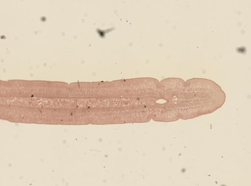 Taenia taeniaeformis