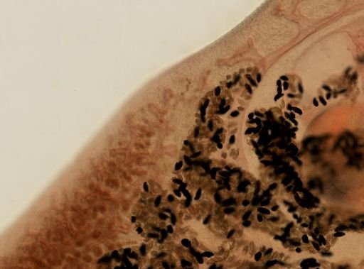 Fasciola hepatica