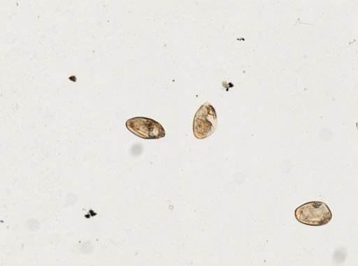 Fasciolopsis buski