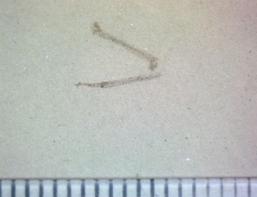 undet. Arthropoda