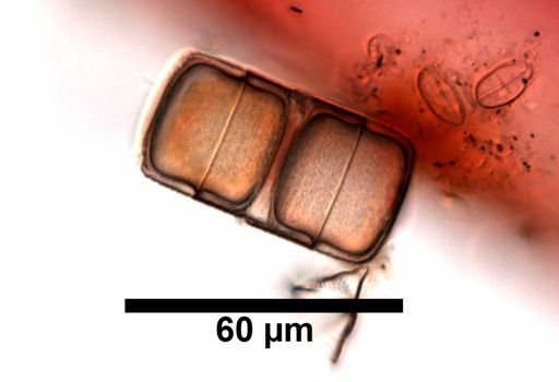 Melosira nummuloides?