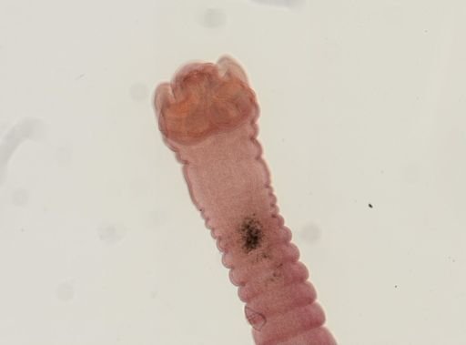 Dipylidium caninum
