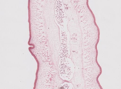 Taenia saginata