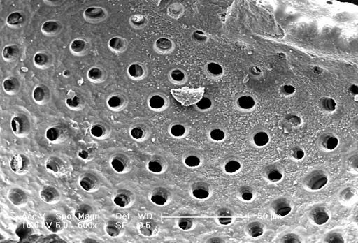 Sphaeroidinella dehiscens
