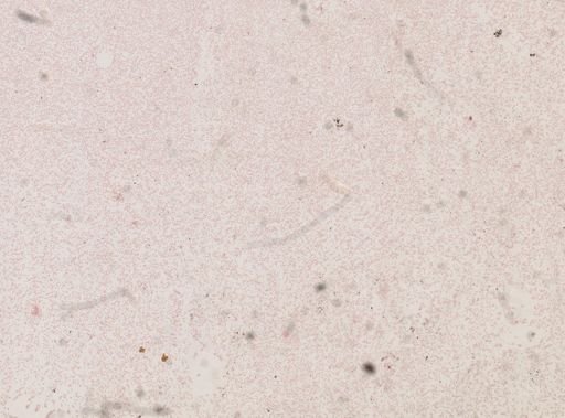 Trypanosoma evansi