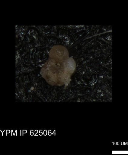 undet. Rugoglobigerinidae
