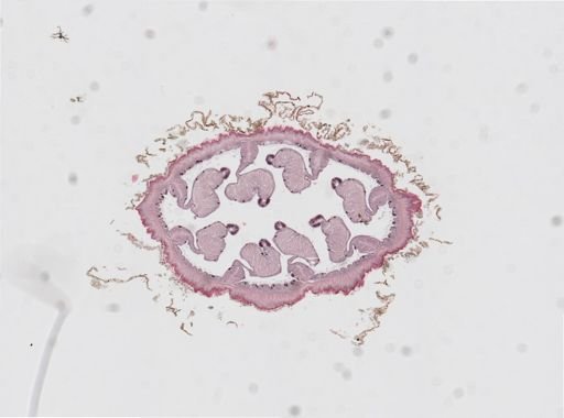 Edwardsia sp.