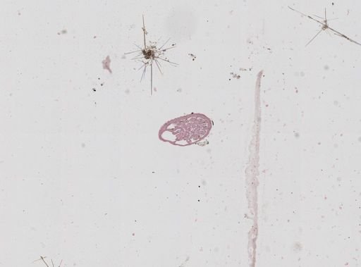 Nematostella