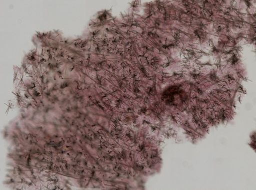 Hymedesmia sp.